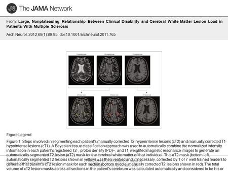 Date of download: 5/28/2016 Copyright © 2016 American Medical Association. All rights reserved. From: Large, Nonplateauing Relationship Between Clinical.