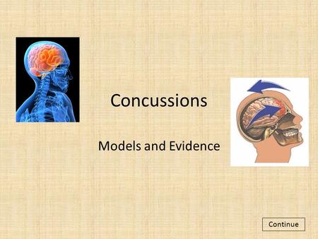 Concussions Models and Evidence Continue. With your partner, read through the slides to learn about concussions. Remember, read carefully so you are able.