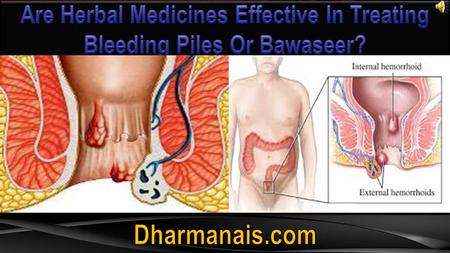  Are herbal medicines effective in treating bleeding piles (or bawaseer, as it is termed in Hindi)? Yes, herbal medicines are safe, effective and permanent.