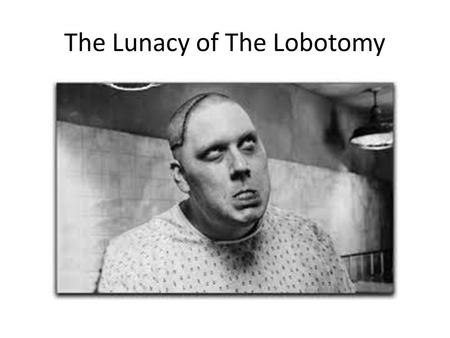 The Lunacy of The Lobotomy. During the lobotomy, connections between lobes of the brain are severed.