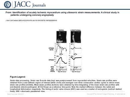 Date of download: 5/29/2016 Copyright © The American College of Cardiology. All rights reserved. From: Identification of acutely ischemic myocardium using.