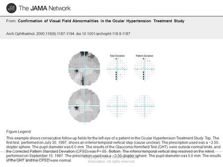 Date of download: 5/29/2016 Copyright © 2016 American Medical Association. All rights reserved. From: Confirmation of Visual Field Abnormalities in the.