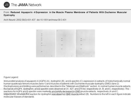 Date of download: 5/29/2016 Copyright © 2016 American Medical Association. All rights reserved. From: Reduced Aquaporin 4 Expression in the Muscle Plasma.