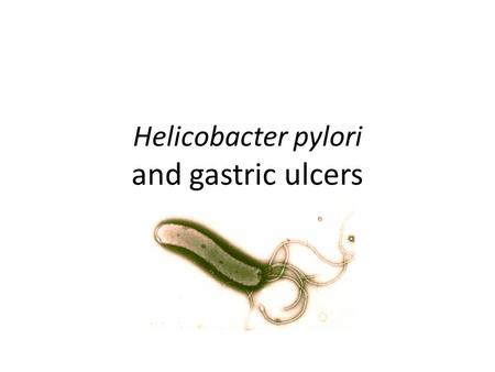 Helicobacter pylori and gastric ulcers. Helicobacter pylori (H. pylori) is a spiral shaped bacterium that lives on the lining of the stomach; inflammation.