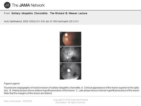 Date of download: 5/29/2016 Copyright © 2016 American Medical Association. All rights reserved. From: Solitary Idiopathic Choroiditis: The Richard B. Weaver.