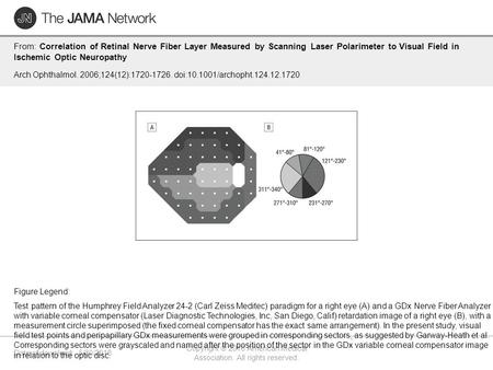 Date of download: 5/30/2016 Copyright © 2016 American Medical Association. All rights reserved. From: Correlation of Retinal Nerve Fiber Layer Measured.