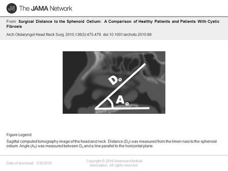 Date of download: 5/30/2016 Copyright © 2016 American Medical Association. All rights reserved. From: Surgical Distance to the Sphenoid Ostium: A Comparison.