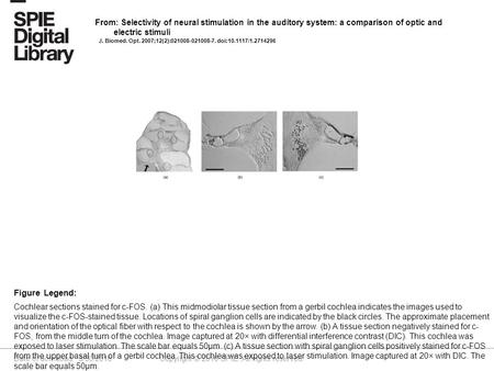 Date of download: 5/30/2016 Copyright © 2016 SPIE. All rights reserved. Cochlear sections stained for c-FOS. (a) This midmodiolar tissue section from a.