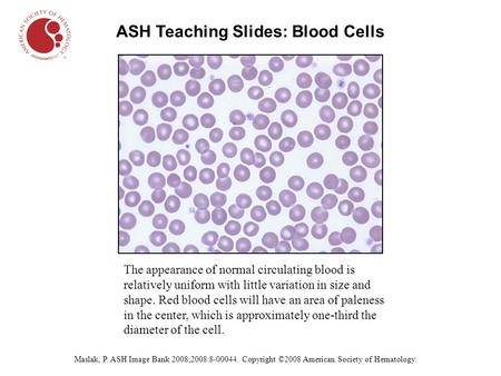 ASH Teaching Slides: Blood Cells