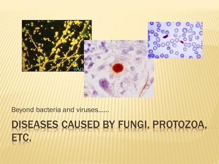 Beyond bacteria and viruses……. u Diverse group of heterotrophs.  Many are ecologically important saprophytes (consume dead and decaying matter)  Others.