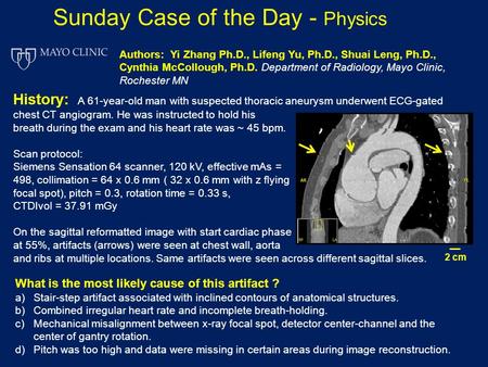 History: A 61-year-old man with suspected thoracic aneurysm underwent ECG-gated chest CT angiogram. He was instructed to hold his breath during the exam.