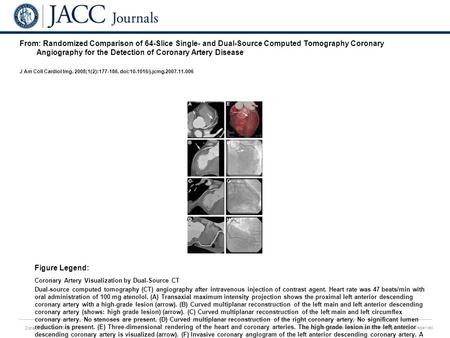 Date of download: 5/30/2016 Copyright © The American College of Cardiology. All rights reserved. From: Randomized Comparison of 64-Slice Single- and Dual-Source.