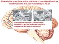 [even prior to taking drugs] Where in the brain, how and at what level of resolution should we look for variants that alter vulnerability to RLS? Brain.