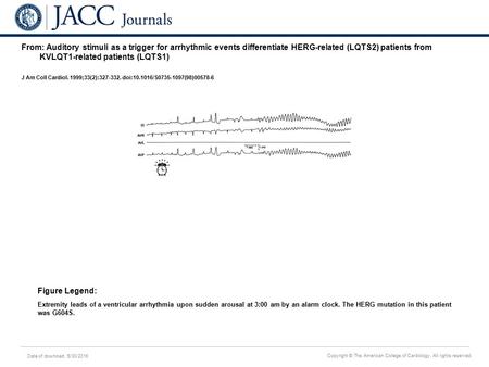 Date of download: 5/30/2016 Copyright © The American College of Cardiology. All rights reserved. From: Auditory stimuli as a trigger for arrhythmic events.