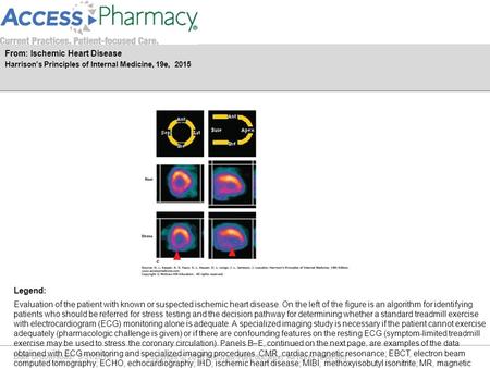 Date of download: 5/31/2016 Copyright © 2016 McGraw-Hill Education. All rights reserved. Evaluation of the patient with known or suspected ischemic heart.