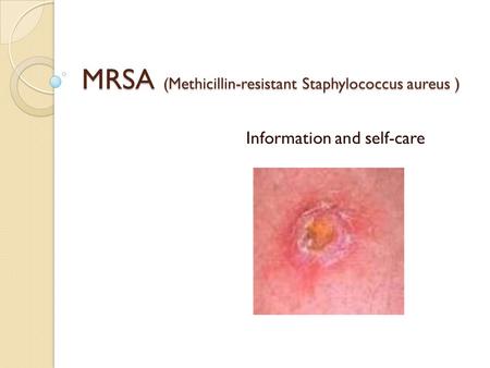 MRSA (Methicillin-resistant Staphylococcus aureus ) Information and self-care.