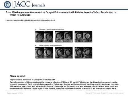 Date of download: 5/31/2016 Copyright © The American College of Cardiology. All rights reserved. From: Mitral Apparatus Assessment by Delayed Enhancement.