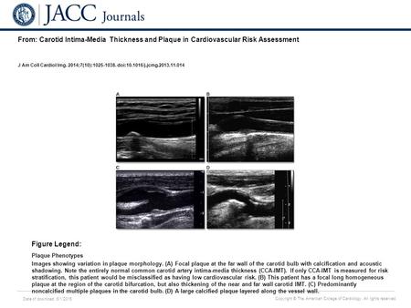 Date of download: 6/1/2016 Copyright © The American College of Cardiology. All rights reserved. From: Carotid Intima-Media Thickness and Plaque in Cardiovascular.