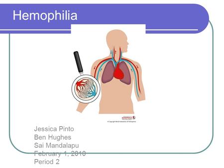 Hemophilia Jessica Pinto Ben Hughes Sai Mandalapu February 1, 2010 Period 2.