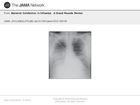 Date of download: 6/1/2016 Copyright © 2016 American Medical Association. All rights reserved. From: Bacterial Coinfection in Influenza: A Grand Rounds.