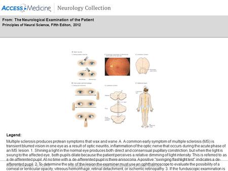 Date of download: 6/1/2016 Copyright © 2016 McGraw-Hill Education. All rights reserved. Multiple sclerosis produces protean symptoms that wax and wane.