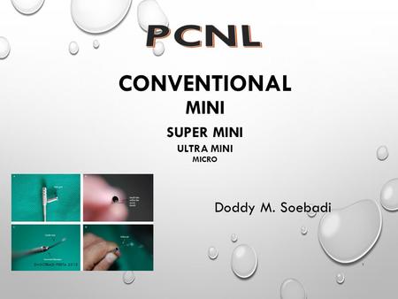 conventional mini super mini ultra mini micro