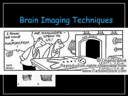 Brain Imaging Techniques