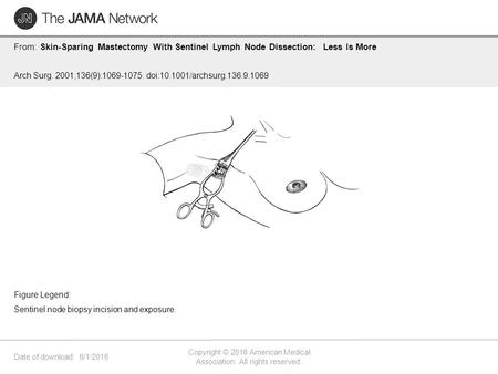 Date of download: 6/1/2016 Copyright © 2016 American Medical Association. All rights reserved. From: Skin-Sparing Mastectomy With Sentinel Lymph Node Dissection: