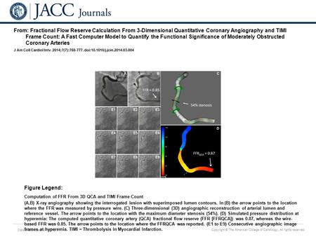 Date of download: 6/1/2016 Copyright © The American College of Cardiology. All rights reserved. From: Fractional Flow Reserve Calculation From 3-Dimensional.