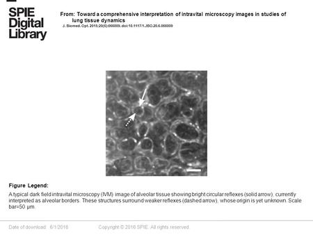 Date of download: 6/1/2016 Copyright © 2016 SPIE. All rights reserved. A typical dark field intravital microscopy (IVM) image of alveolar tissue showing.