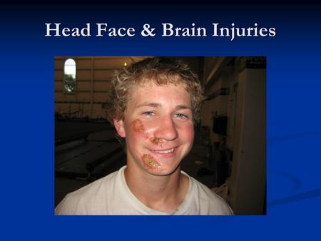 Head Face & Brain Injuries. Head Injures Head injury-damage to the scalp, skull or brain due to a blow Head injury-damage to the scalp, skull or brain.