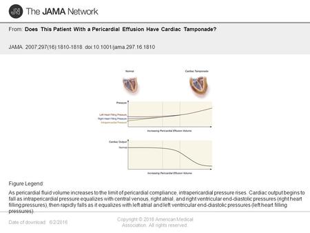 Date of download: 6/2/2016 Copyright © 2016 American Medical Association. All rights reserved. From: Does This Patient With a Pericardial Effusion Have.