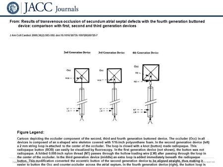 Date of download: 6/3/2016 Copyright © The American College of Cardiology. All rights reserved. From: Results of transvenous occlusion of secundum atrial.