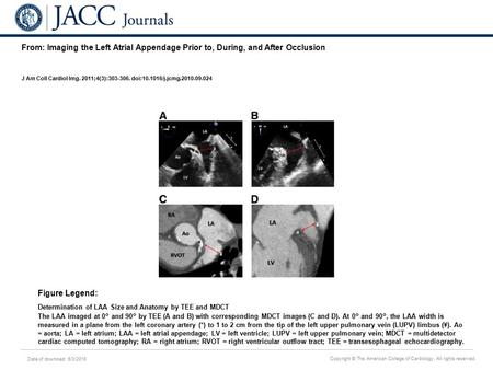 Date of download: 6/3/2016 Copyright © The American College of Cardiology. All rights reserved. From: Imaging the Left Atrial Appendage Prior to, During,