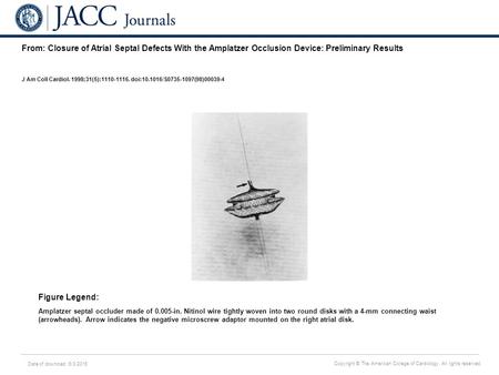 Date of download: 6/3/2016 Copyright © The American College of Cardiology. All rights reserved. From: Closure of Atrial Septal Defects With the Amplatzer.