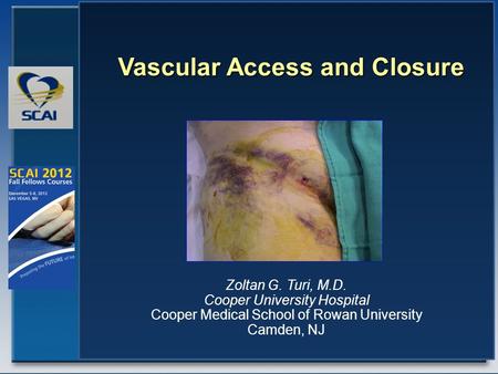 Zoltan G. Turi, M.D. Cooper University Hospital Cooper Medical School of Rowan University Camden, NJ Vascular Access and Closure.