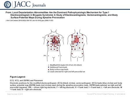 Date of download: 6/3/2016 Copyright © The American College of Cardiology. All rights reserved. From: Local Depolarization Abnormalities Are the Dominant.