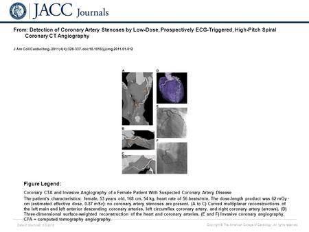 Date of download: 6/3/2016 Copyright © The American College of Cardiology. All rights reserved. From: Detection of Coronary Artery Stenoses by Low-Dose,