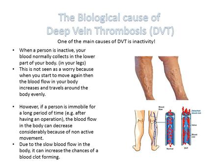 One of the main causes of DVT is inactivity! When a person is inactive, your blood normally collects in the lower part of your body. (in your legs) This.