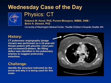 Wednesday Case of the Day History: CT pulmonary angiography (image shown) was performed on a 24-year-old female patient with pleuritic chest pain and increased.