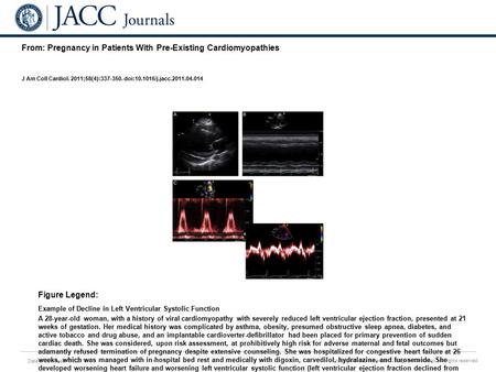 Date of download: 6/3/2016 Copyright © The American College of Cardiology. All rights reserved. From: Pregnancy in Patients With Pre-Existing Cardiomyopathies.