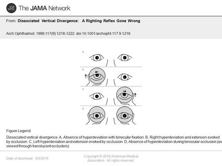 Date of download: 6/3/2016 Copyright © 2016 American Medical Association. All rights reserved. From: Dissociated Vertical Divergence: A Righting Reflex.