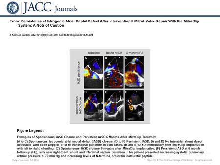 Date of download: 6/3/2016 Copyright © The American College of Cardiology. All rights reserved. From: Persistence of Iatrogenic Atrial Septal Defect After.