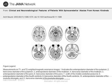 Date of download: 6/3/2016 Copyright © 2016 American Medical Association. All rights reserved. From: Clinical and Neuroradiological Features of Patients.