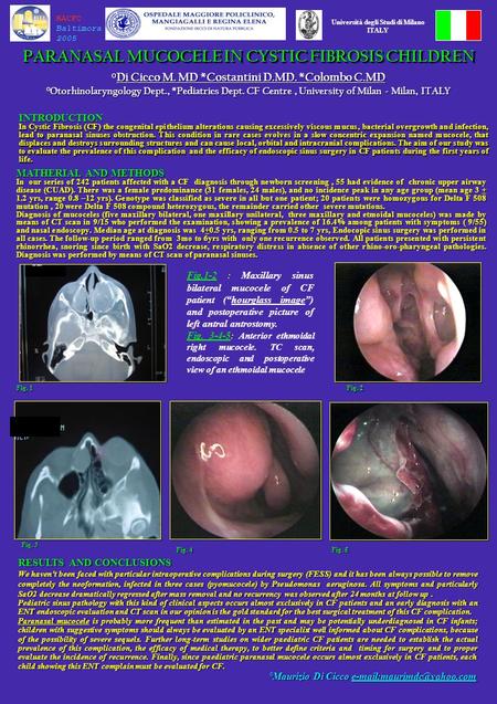 PARANASAL MUCOCELE IN CYSTIC FIBROSIS CHILDREN °Di Cicco M. MD *Costantini D.MD. *Colombo C.MD °Otorhinolaryngology Dept., *Pediatrics Dept. CF Centre,