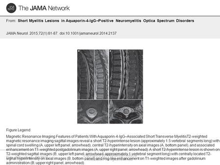 Date of download: 6/9/2016 Copyright © 2016 American Medical Association. All rights reserved. From: Short Myelitis Lesions in Aquaporin-4-IgG–Positive.