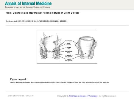 Date of download: 6/9/2016 From: Diagnosis and Treatment of Perianal Fistulas in Crohn Disease Ann Intern Med. 2001;135(10):906-918. doi:10.7326/0003-4819-135-10-200111200-00011.