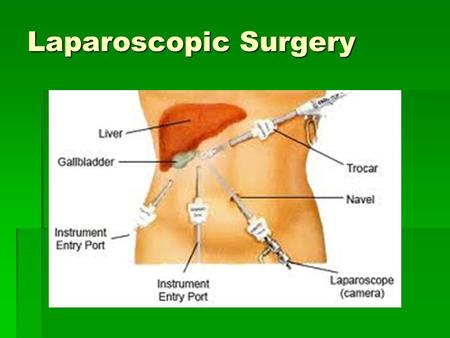 Laparoscopic Surgery. What is Laparoscopic surgery?  Laparoscopic surgery also referred as Key hole surgery describes the performance of surgical procedures.