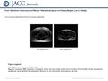 Date of download: 6/17/2016 Copyright © The American College of Cardiology. All rights reserved. From: Beneficial Cardiovascular Effects of Bariatric Surgical.