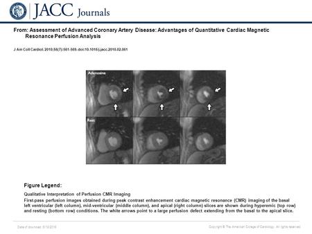 Date of download: 6/18/2016 Copyright © The American College of Cardiology. All rights reserved. From: Assessment of Advanced Coronary Artery Disease: